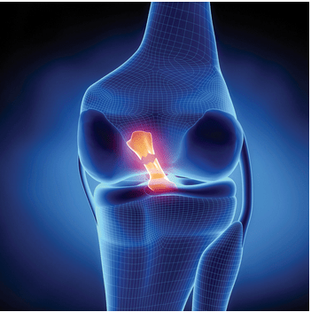 What Do I Need To Do After a Knee Injury To Return To Sport?