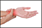 Hand Wrist Pain