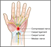 Hand Wrist Pain 5